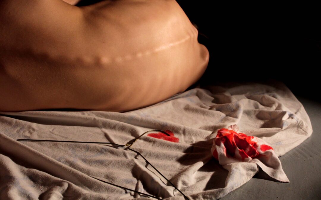 8-HistoireFemme-SamaëlleLandry-CJonq – copie